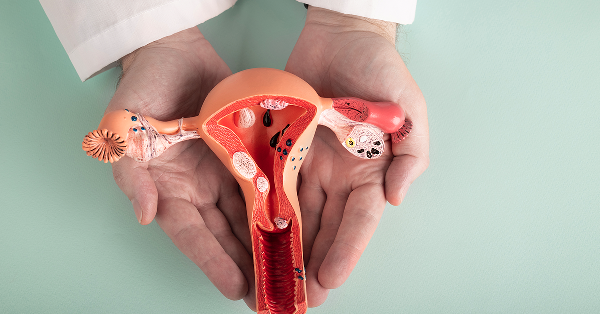 tratamiento para endometriosis en León Gto